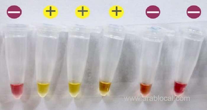 simple,-reliable-rapid-covid-19-test-developed-by-reserchers-in-oman_kuwait