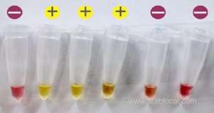 simple,-reliable-rapid-covid-19-test-developed-by-reserchers-in-oman_kuwait