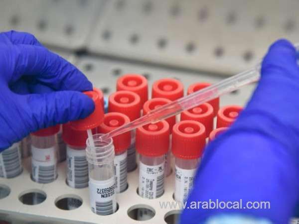 who-hopeful-about-availability-of-covid-19-vaccine_kuwait